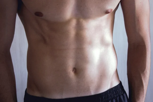 Abdominoplastia para Hombres en Dallas, TX