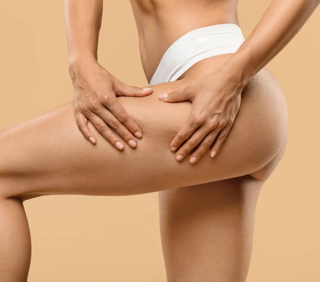 Cruroplastia en Dallas, TX - Lifting de Muslos Cruroplastia en Dallas, TX - Lifting de Muslos
