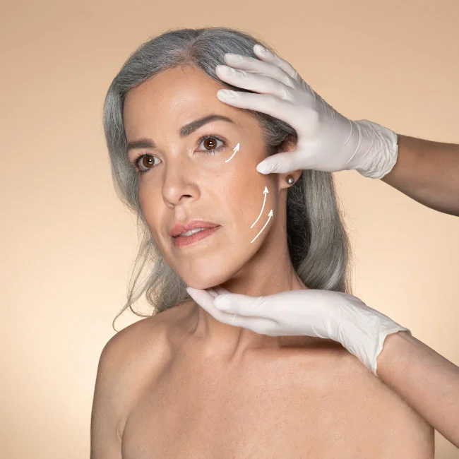 Different Phases Approach of Dr. Cocco for Facelift Surgery Different Phases Approach of Dr. Cocco for Facelift Surgery