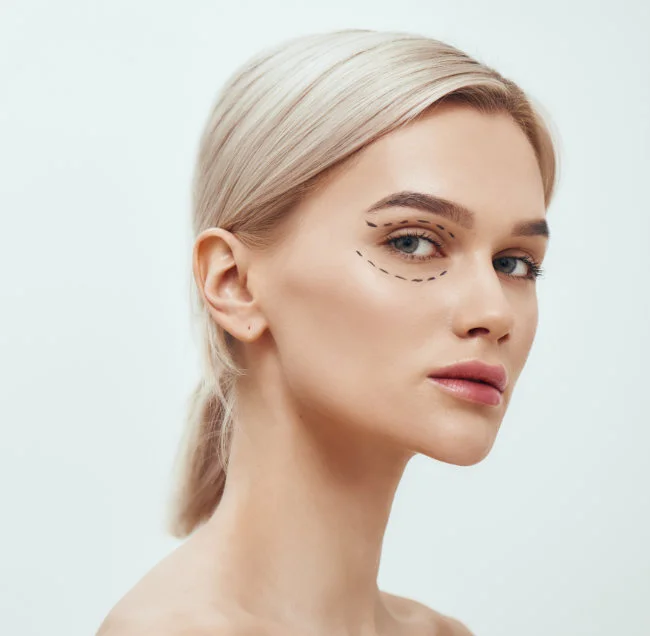 Fat Grafting around the eye area