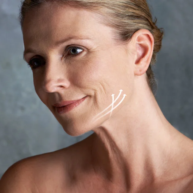 Lifting Facial Inferior en Dallas, TX - Cirugia de Contorno Mandibular